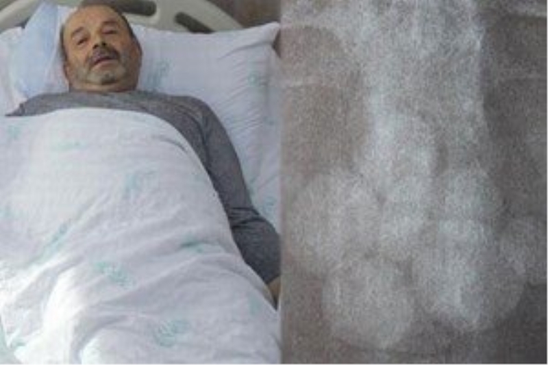 10 yıl dayanılmaz ağrılarla yaşadı!