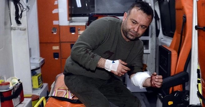 Aleyna Tilki`nin aranjörü saldırıya uğradı