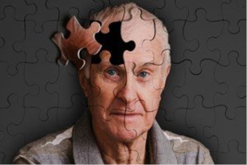 Alzheimer?da büyük umut doğdu!...