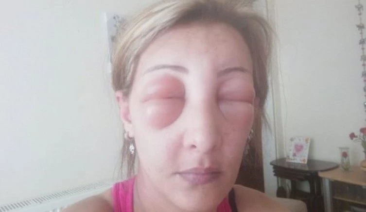 AZ DAHA CANINDAN OLUYORDU
