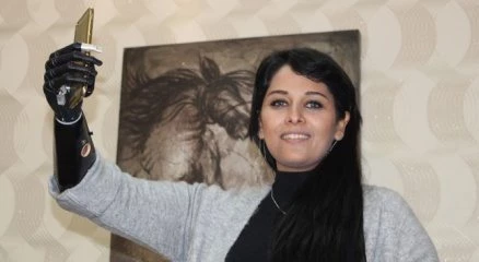 Biyonik eliyle hayata üçüncü kez dokundu