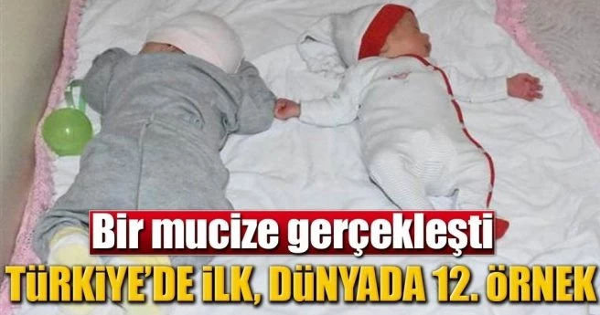 Çelik çiftinin tıp literatürüne geçen doğumla iki çocukları oldu