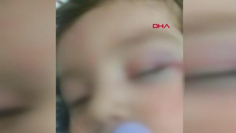 ÇOCUĞUNA SİGARA İÇİRİP ÖLMESİ İÇİN İLAÇ VEREN ANNE GÖZALTINDA