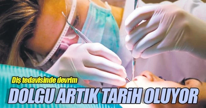 Diş dolgusu tarih oluyor