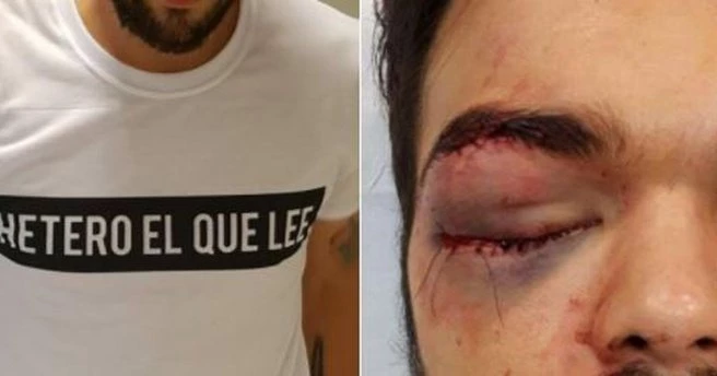 Eşcinsel ragbi sporcusu 7 kişinin saldırısına uğradı