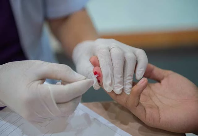 HIV belirtileri nelerdir?