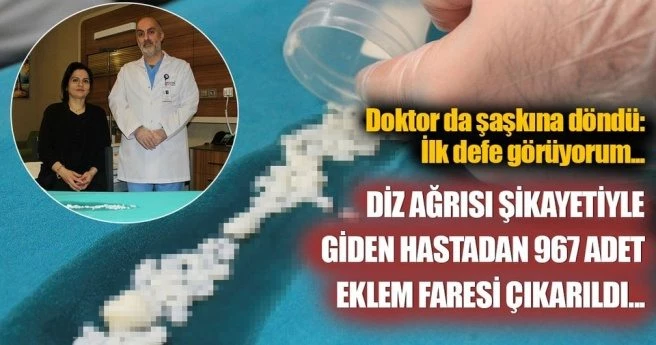 KADIN HASTANIN DİZLERİNDEN 967 TANE EKLEM FARESİ ÇIKTI