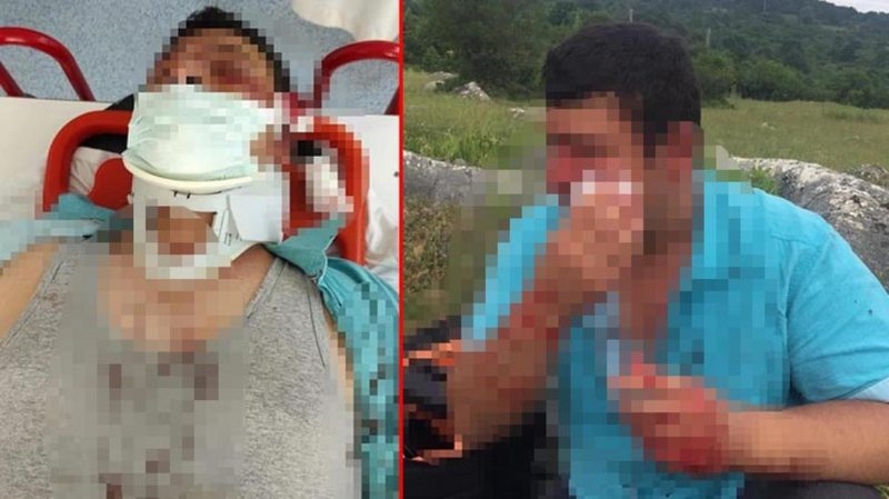 Lütfü Türkkan`ın kaçak çiftliğinin yıkımını görüntüleyen muhabir darbedildi