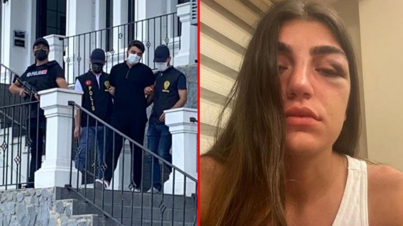 Manken Gizem Akbaş`ı öldüresiye döven eski sevgilisi, ifadesinde her şeyi anlattı: Erkeklerle nispet yapınca darbettim
