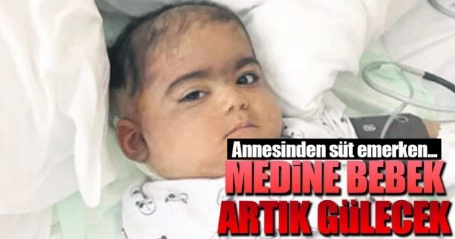 Medine bebek artık gülecek