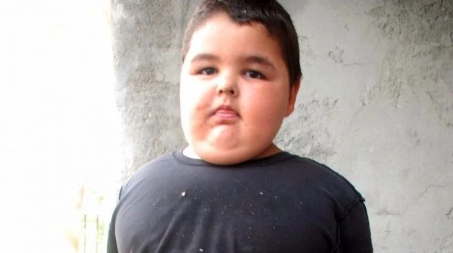 Nedeni bilinmiyor... 4 yaşında 62 kilo!