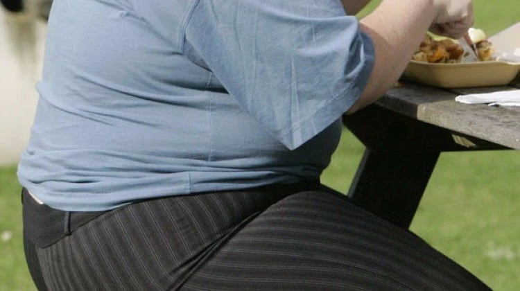 Obezite cerrahisinde Türkiye'de bir ilk