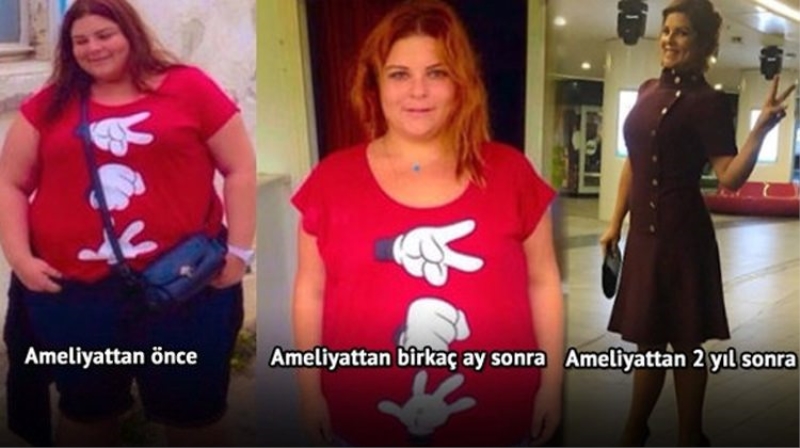 Pelin Öztürk'ün son hali görenleri şoke etti! Ünlü oyuncu eridi