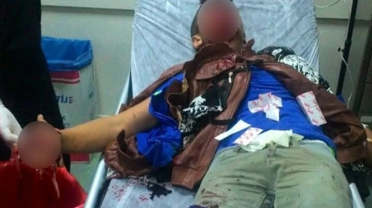 Polise atmak istediği bomba elinde patladı