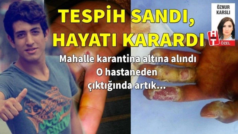 Radyoaktif tespih yüzde 80 engelli bıraktı