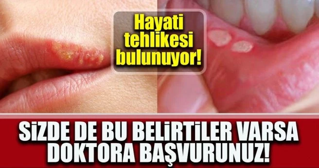 Sizde de bu belirtiler varsa doktora başvurunuz!