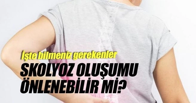SKOLYOZ EGZERSİZ YAPMANIZA ENGEL DEĞİL