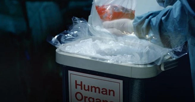 Türk Böbrek Vakfı`nı arayıp `organ satmak istiyorum` diyorlar