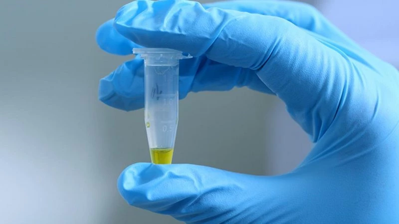Türk hekimler yapılmayanı yaptı! 15 saniyede idrardan korona testi
